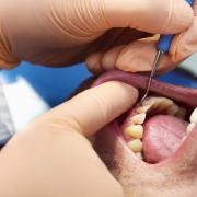 A dentist has warned using a hard toothbrush to clean retainers or Invisalign braces can be harmful